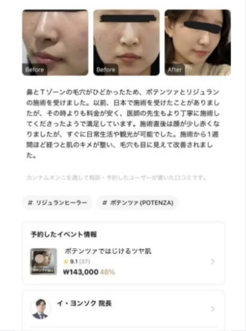 강남언니 리뷰 1