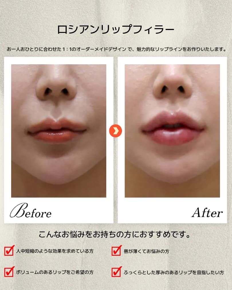 Jaw, lip & dental Before & After — Dasion Clinic