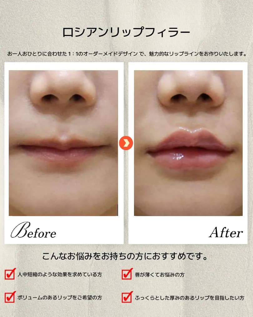 Jaw, lip & dental Before & After — Dasion Clinic