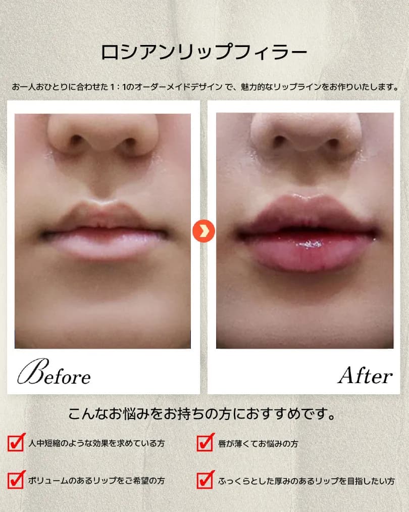 Jaw, lip & dental Before & After — Dasion Clinic