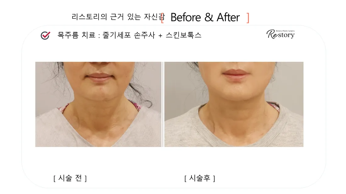 Skin Before & After — Restory Plastic Surgery