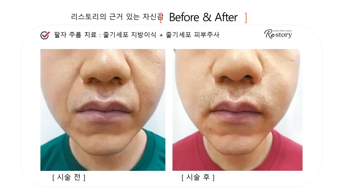 Skin Before & After — Restory Plastic Surgery