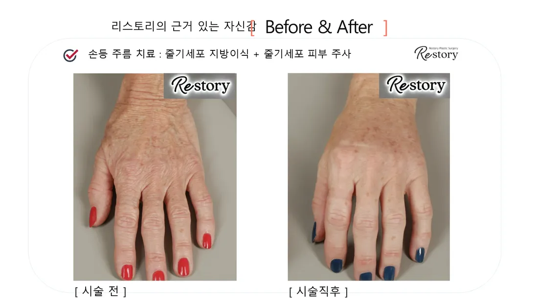 Skin Before & After — Restory Plastic Surgery