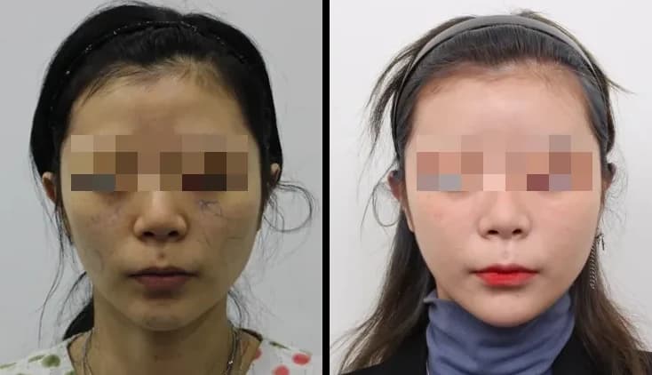 Skin Before & After — Restory Plastic Surgery