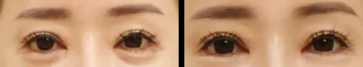 Skin Before & After — Restory Plastic Surgery