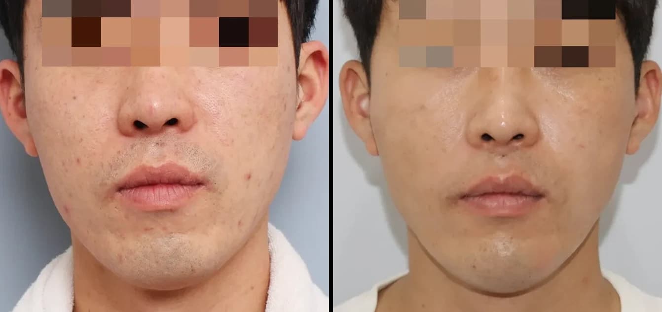 Skin Before & After — Restory Plastic Surgery